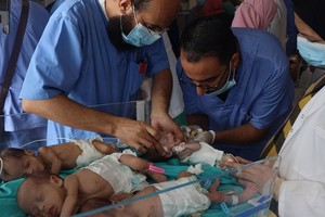 加沙北部希法医院的医务人员正在给婴儿提供治疗，以便他们接下来能够给安全转移。（图：联合国）