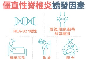 僵直性脊椎炎不只下背痛！