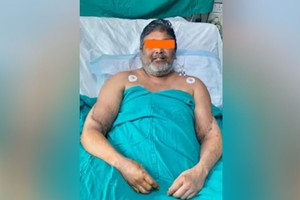 男画家成功移植女性小臂