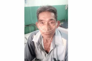 男子操劳过度患上肺痨