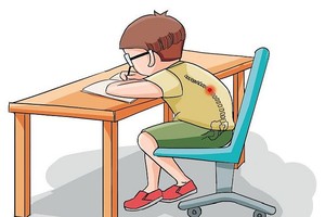 注意儿童体态！趴桌、弓背当心脊柱侧弯