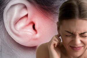 警惕耳鸣提示的身体隐患