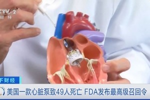 美 FDA 就一款心臟泵因安全风险发最高级召回令