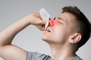 经常流鼻血是怎么回事？