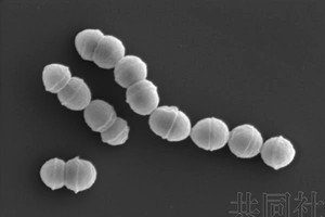 图为感染“链球菌中毒休克综合征”的主要原因物质“A组溶血性链球菌”。（图：共同社）