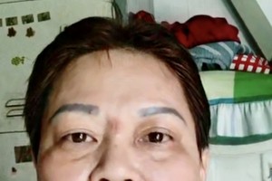 遭车撞断脚 生活陷困境