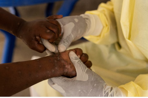 卫生部要求加强各口岸区域的监察工作，以及时发现各疑似病例。（示意图：路透社）