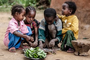 营养不良正威胁着非洲许多地区儿童的生命。（图：联合国）