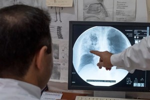 结核病感染创28年来新高。（图：WHO）