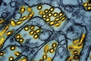  专家说，牛打喷嚏，鸡也会咳嗽和打喷嚏，如果它们感染禽流感病毒，病毒颗粒可能通过空气传播。 （图：AP）