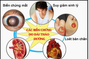 血糖高但没症状要治疗吗？