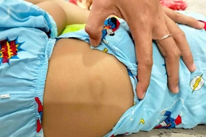 Bé gái hơn 2 tuổi bị chấn thương "vùng kín" nghi xảy ra tại điểm giữ trẻ tự phát
