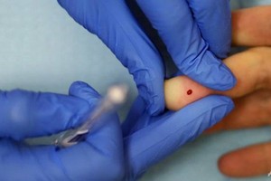 Illustrative image (Source: channelnewsasia.com)