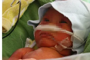 “Cái ôm đầu tiên” - Hướng tới 4 triệu trẻ sơ sinh tiếp theo