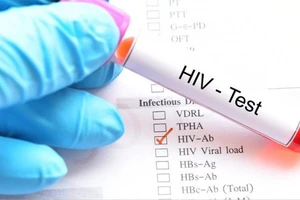 Xu hướng dịch HIV/AIDS đang thay đổi, ca mắc gia tăng nhiều ở nam giới