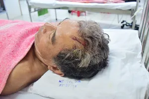 Chủ tịch UBND tỉnh Thừa Thiên – Huế hứa xử nghiêm “cát tặc” chém trọng thương người dân