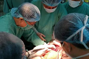 Lần đầu cắt gan bằng kỹ thuật bảo tồn ở Bệnh viện Trung ương Huế
