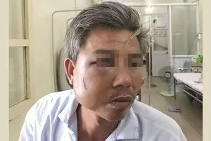 Khởi tố chủ quán cà phê Bố Già đánh trọng thương công nhân cây xanh