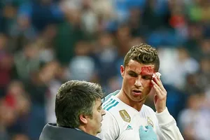 Ronaldo đổ máu vì dính gầm giày đối phương. Ảnh: Getty Images