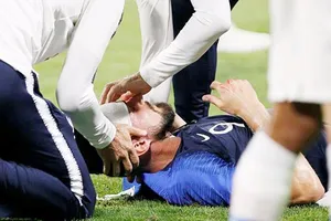 Giroud gặp chấn thương đầu. Ảnh: Getty Images 