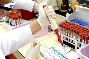 Giới khoa học đang tìm kiếm vaccine phòng chống HIV/AIDS hiệu quả nhất 