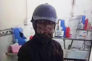 Làm rõ thông tin “ăn mày mặt đen”