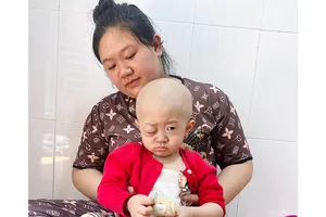 Bé gái 2 tuổi bị ung thư hốc mắt