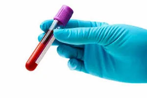 Sàng lọc ADN xét nghiệm ung thư