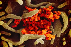 Biến thể D614G được tìm thấy trong 4 ca nhiễm virus SARS-CoV-2 tại 2 cụm dịch của Malaysia. Ảnh: Bloomberg