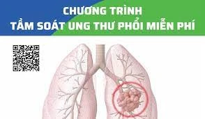 75% bệnh nhân ung thư phổi được chẩn đoán ở giai đoạn cuối