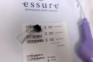 Dụng cụ tránh thai Essure của Bayer. Nguồn: KCGR