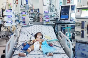 Bé gái trụy tim, nguy kịch do mắc tay chân miệng. Ảnh: Bệnh viện cung cấp