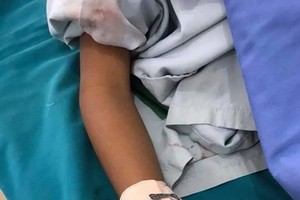 一名男童的手因一節在路邊拾起的電芯爆炸而受傷。（圖片來源：互聯網）