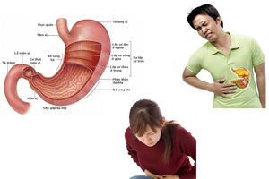 一個人吃飯容易得胃病。