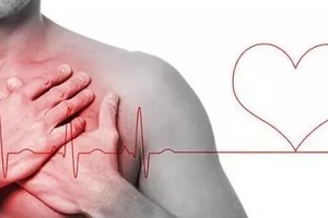 （示意圖源：互聯網。）