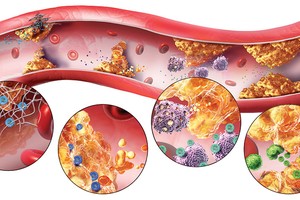 （示意圖源：互聯網）