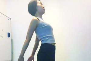 倒著走真能治腰椎痛頸椎痛？