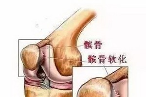 （圖源：互聯網）