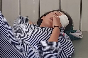 學生裴Ng.Q.A(14歲)，處於眼角膜破裂、內眼球嚴重受損等狀態下進院急救。