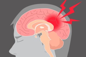 （示意圖源：互聯網）