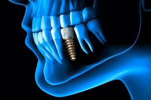 （圖源：互聯網）