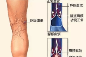 （示意圖源：互聯網） 