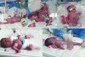 據韓聯社報導，據首爾大學醫院19日消息，韓國陸軍第17師的一對大尉夫婦前一天晚上10時許喜獲五胞胎。