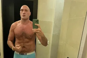 Hình ảnh trần tình của Fury trên Instagram: "Không thể không bị thương khi đấu tập"