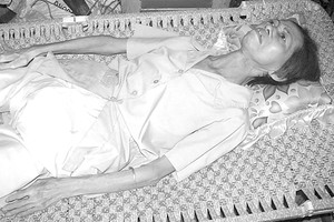 黃燕玲瘦骨如柴，一直躺在長椅上。