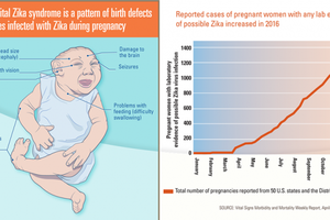 美約一成染寨卡孕婦面臨缺陷寶寶問題。（圖片來源：互聯網）