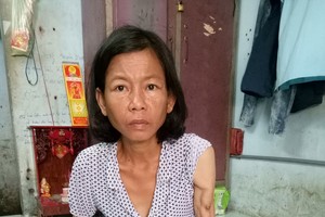 洗腎使陳香的手臂浮腫，全身消瘦。