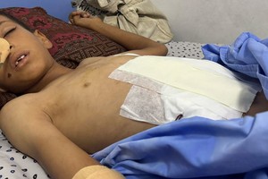 一名男孩在加沙市的一家医院接受治疗。