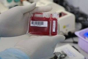 National hematology institute expands stem cell collection services