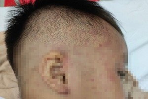 Doctors timely save four-year-old boy being abused, locked inside freezer